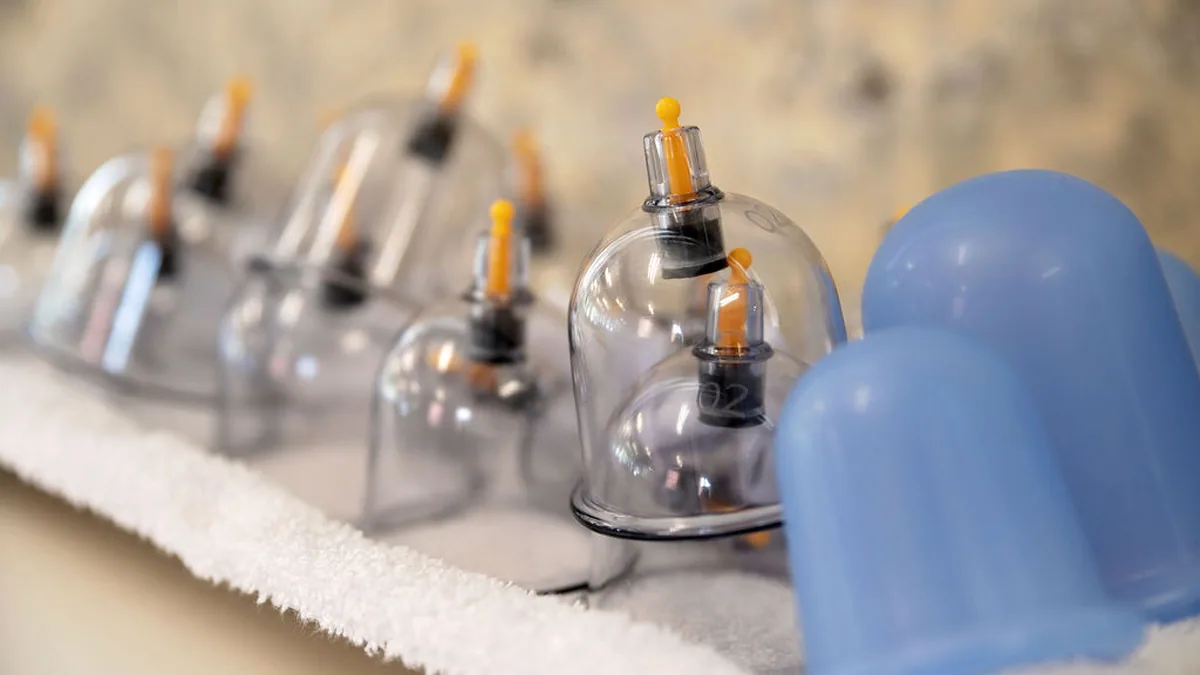 Add Cupping to Massage Therapy!
