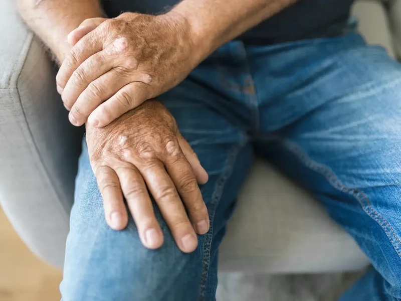 Arthritic hands resting on a knee