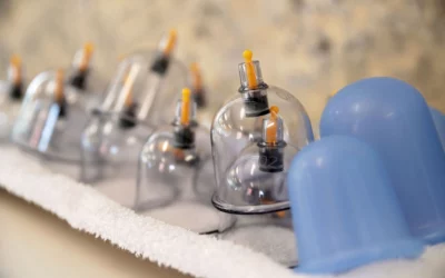 Add Cupping to Massage Therapy!